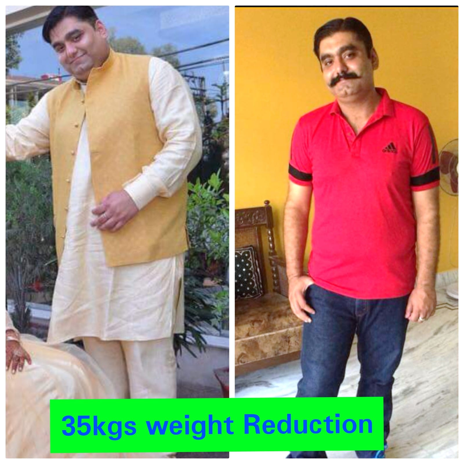 Transformation 1